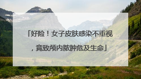 好险！女子皮肤感染不重视，竟致颅内脓肿危及生命